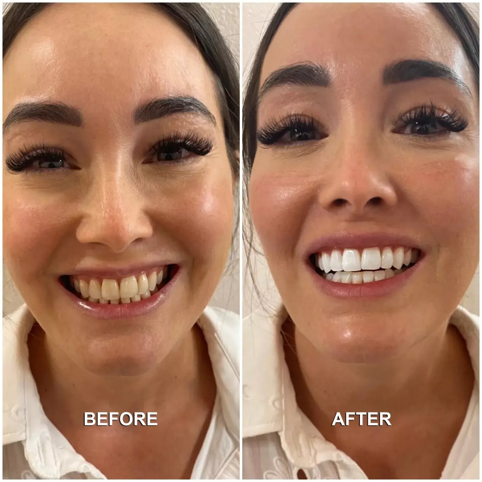 GlowSmile™ Pro - Ultrasone Tandenreiniger